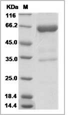 Human M-CSF / CSF-1 Protein (Fc Tag)