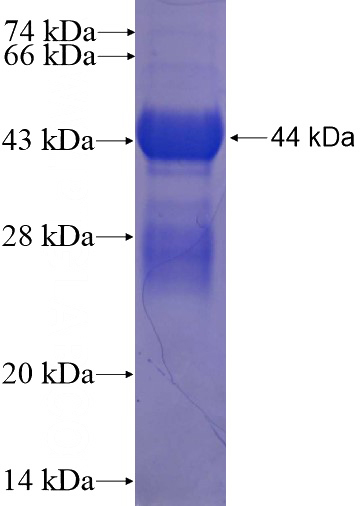 Recombinant Human MKNK2 SDS-PAGE