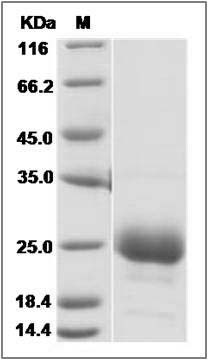 Cynomolgus CD160 Protein SDS-PAGE