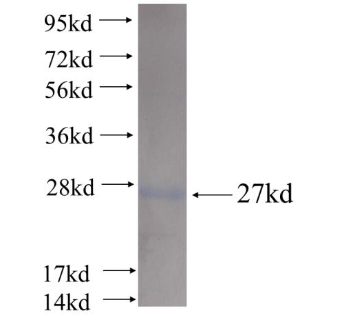 Recombinant human RAC1/2/3 SDS-PAGE