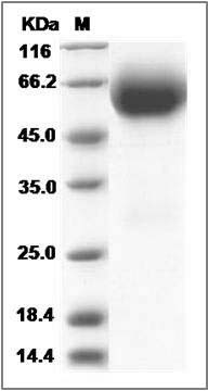 Rat IL18R1 Protein (His Tag) SDS-PAGE