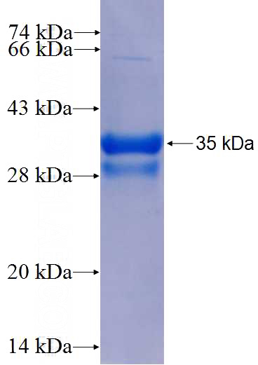 Recombinant Human MSI1 SDS-PAGE