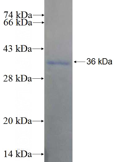 Recombinant Human KIAA1328 SDS-PAGE