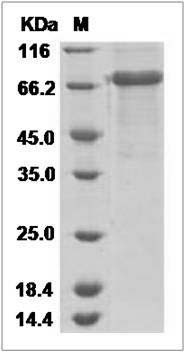 Mouse TMEFF1 / Tomoregulin-1 Protein (Fc Tag) SDS-PAGE