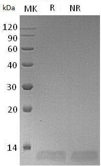 Human CXCL6/GCP2/SCYB6 (His tag) recombinant protein
