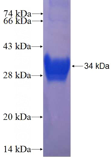 Recombinant Human GNG2 SDS-PAGE