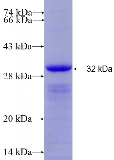 Recombinant Human FGFBP1 SDS-PAGE