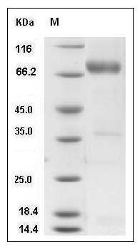 Human NRG1-beta 1 Protein (Fc Tag) SDS-PAGE