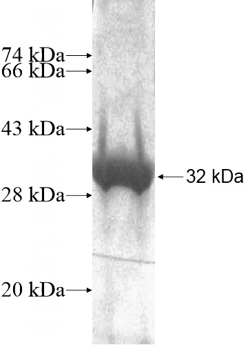 Recombinant Human SPSB4 SDS-PAGE
