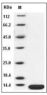 Human B2M / Beta-2-microglobulin Protein (His Tag) SDS-PAGE