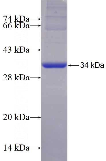 Recombinant Human CYP11A1 SDS-PAGE