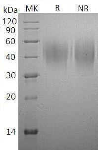 Rat Cd86/rCG_52586 (His tag) recombinant protein