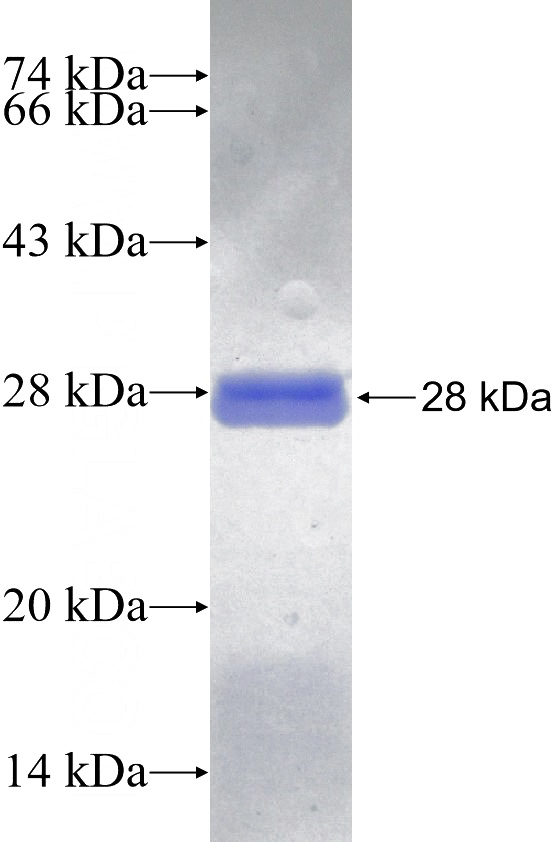 Recombinant Human HOMER2 SDS-PAGE