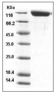 Mouse ANPEP / APN / CD13 Protein (His Tag) SDS-PAGE