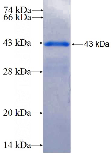 Recombinant Human ADAMTS5 SDS-PAGE
