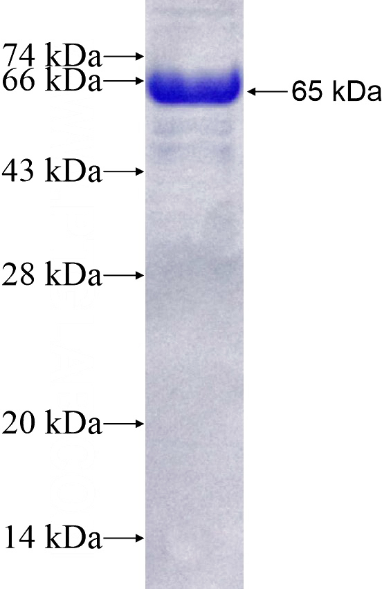 Recombinant Human MAPKAPK2 SDS-PAGE