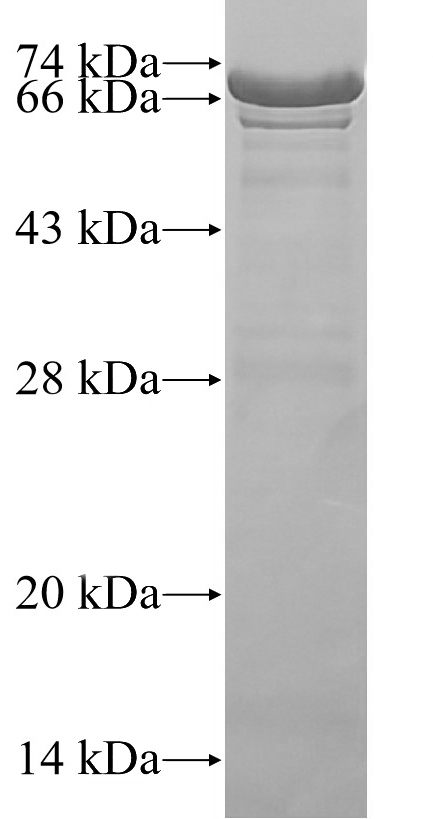 Recombinant human SKAP2(Full length) SDS-PAGE