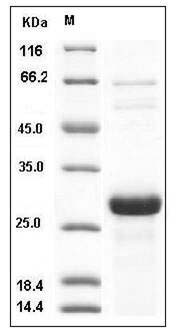 Human SNAP25 / SUP Protein (His Tag) SDS-PAGE