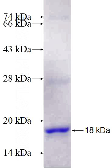 Recombinant Human CELSR2 SDS-PAGE