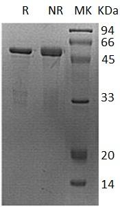 Human NFYA (GST tag) recombinant protein