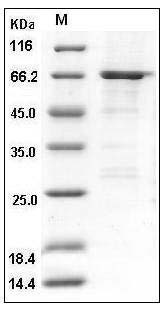 Human ATL1 / SPG3A / Atlastin-1 Protein (GST Tag) SDS-PAGE