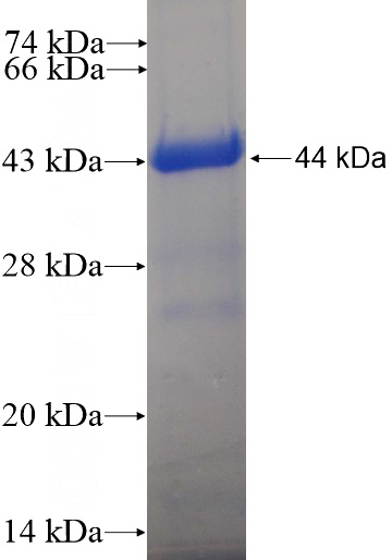 Recombinant Human TRMT11 SDS-PAGE