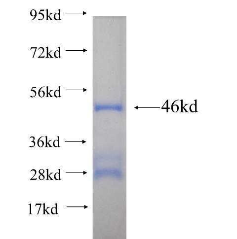 Recombinant human MSRB2 SDS-PAGE