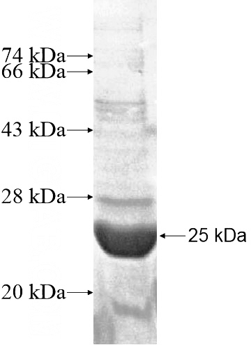 Recombinant Human SLC44A5 SDS-PAGE