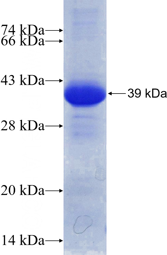 Recombinant Human UTX SDS-PAGE