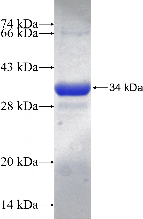 Recombinant Human SLC4A3 SDS-PAGE