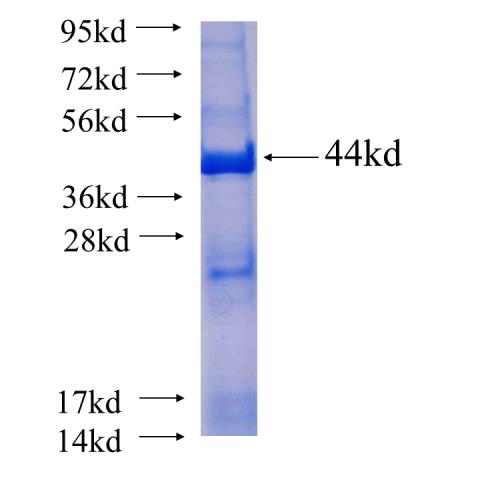 Recombinant human MYO1E SDS-PAGE