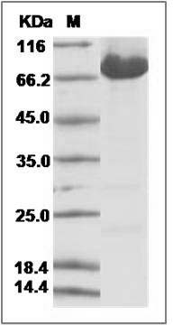 Human KIAA1279 Protein SDS-PAGE