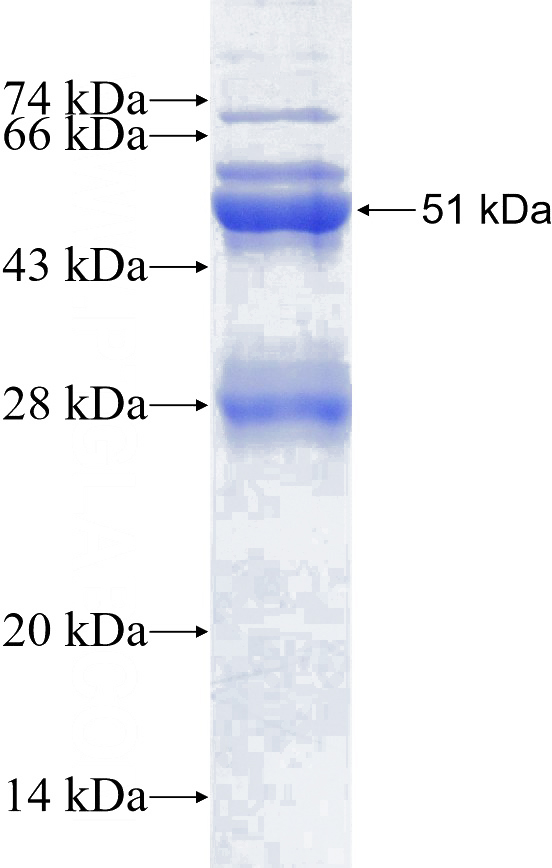 Recombinant Human FZD7 SDS-PAGE