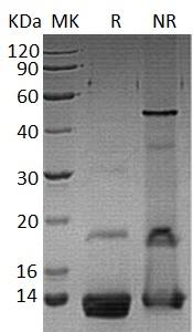 Human RETN/FIZZ3/HXCP1/RSTN (His tag) recombinant protein