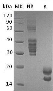 Human VEGFA/VEGF (His tag) recombinant protein