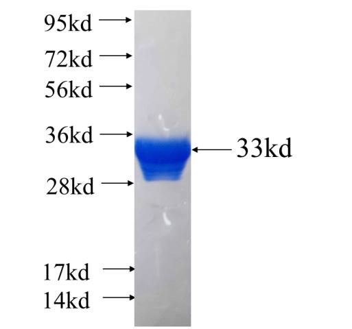 Recombinant human SOX17 SDS-PAGE
