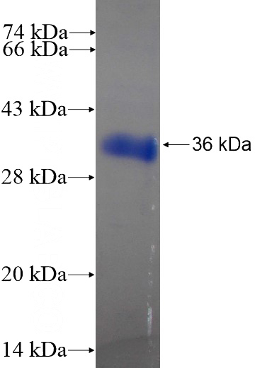 Recombinant Human CENPO SDS-PAGE