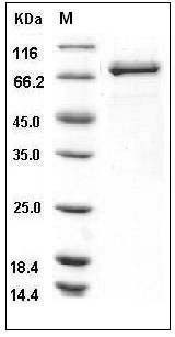 Human Lyn Kinase Protein (GST Tag) SDS-PAGE