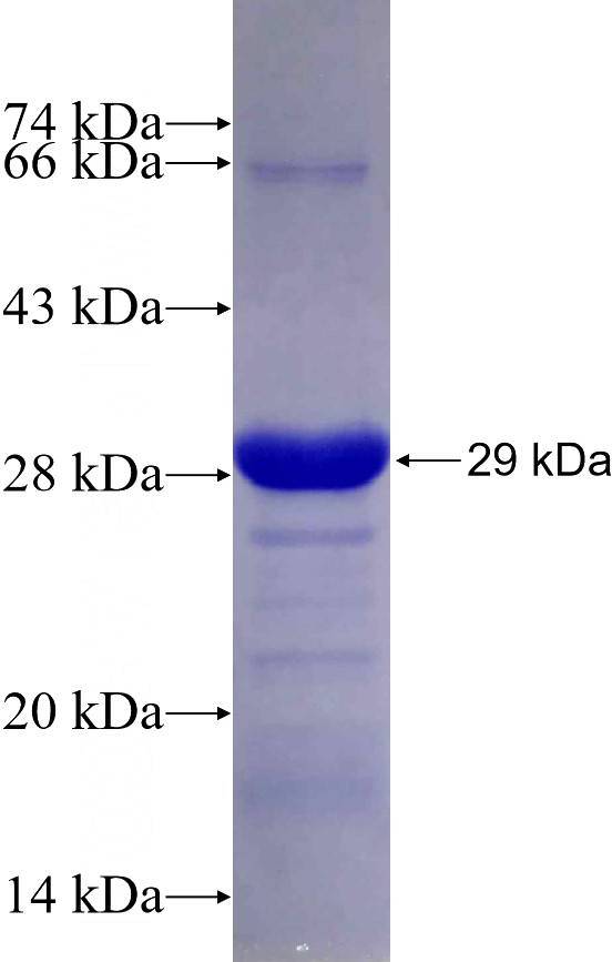 Recombinant Human CENPF SDS-PAGE