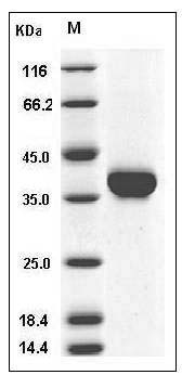 Mouse Carbonic Anhydrase X / Car10 Protein (His Tag) SDS-PAGE