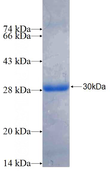 Recombinant Human RAB38 SDS-PAGE