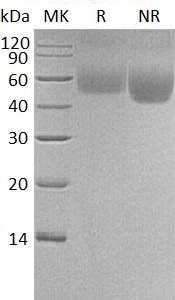 Human LSAMP/IGLON3/LAMP (His tag) recombinant protein