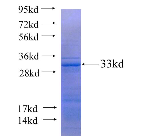 Recombinant human CCDC42 SDS-PAGE