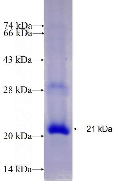Recombinant Human PMS1 SDS-PAGE