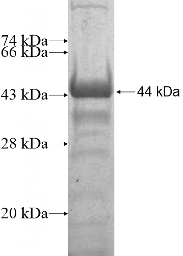 Recombinant Human C1orf87 SDS-PAGE