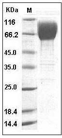 Human CD80 / B7-1 Protein (His & Fc Tag) SDS-PAGE