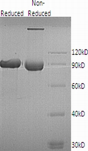 Human MMP9/CLG4B (His tag) recombinant protein
