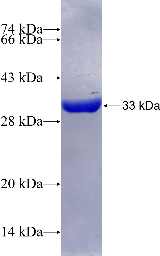 Recombinant Human UMPS SDS-PAGE