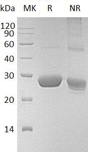 Human LYPLA2/APT2 (His tag) recombinant protein