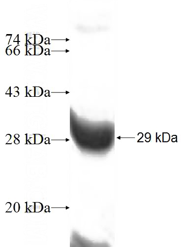 Recombinant Human POP4 SDS-PAGE
